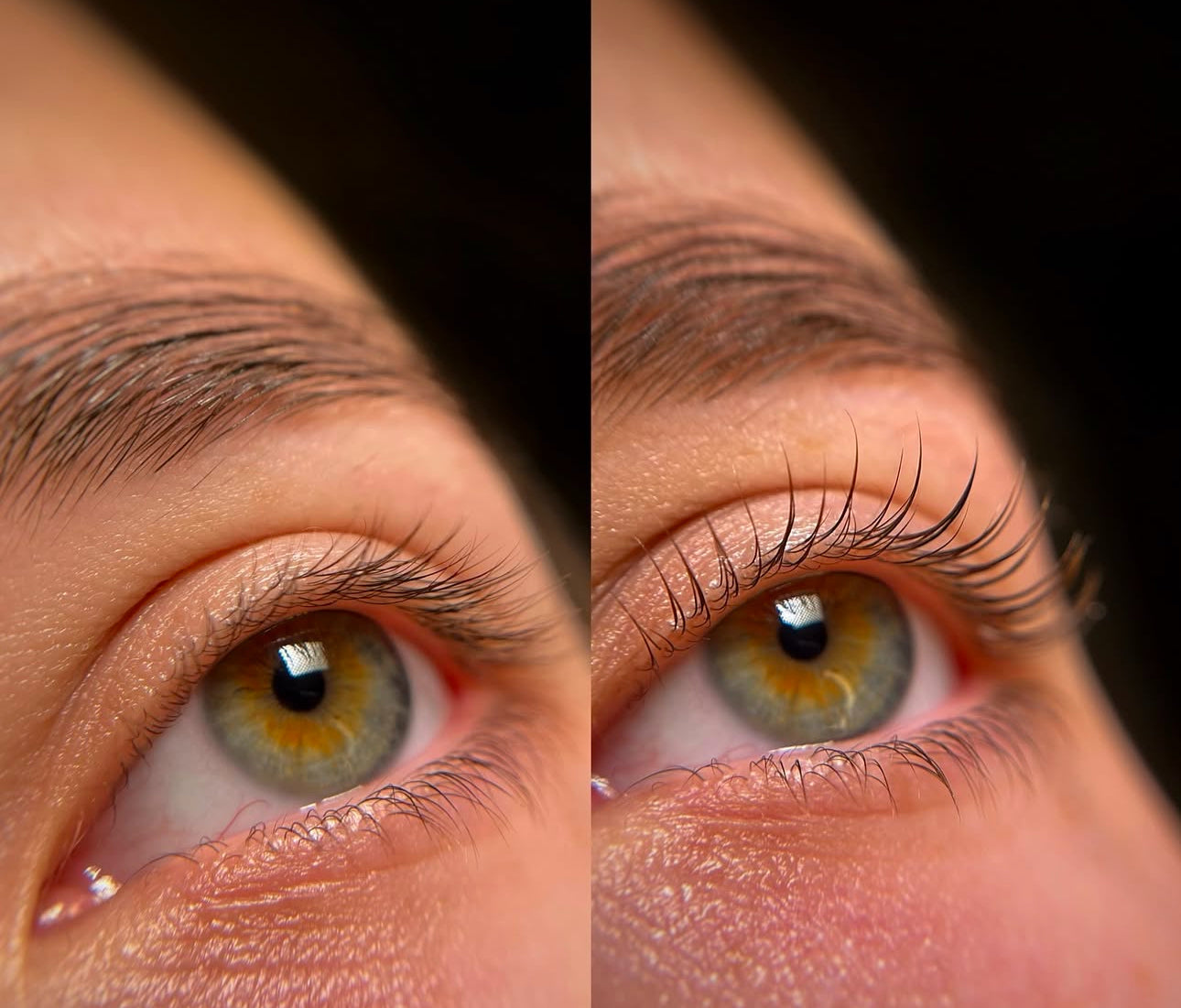 Avant après Step 2 FIXATEUR OKO