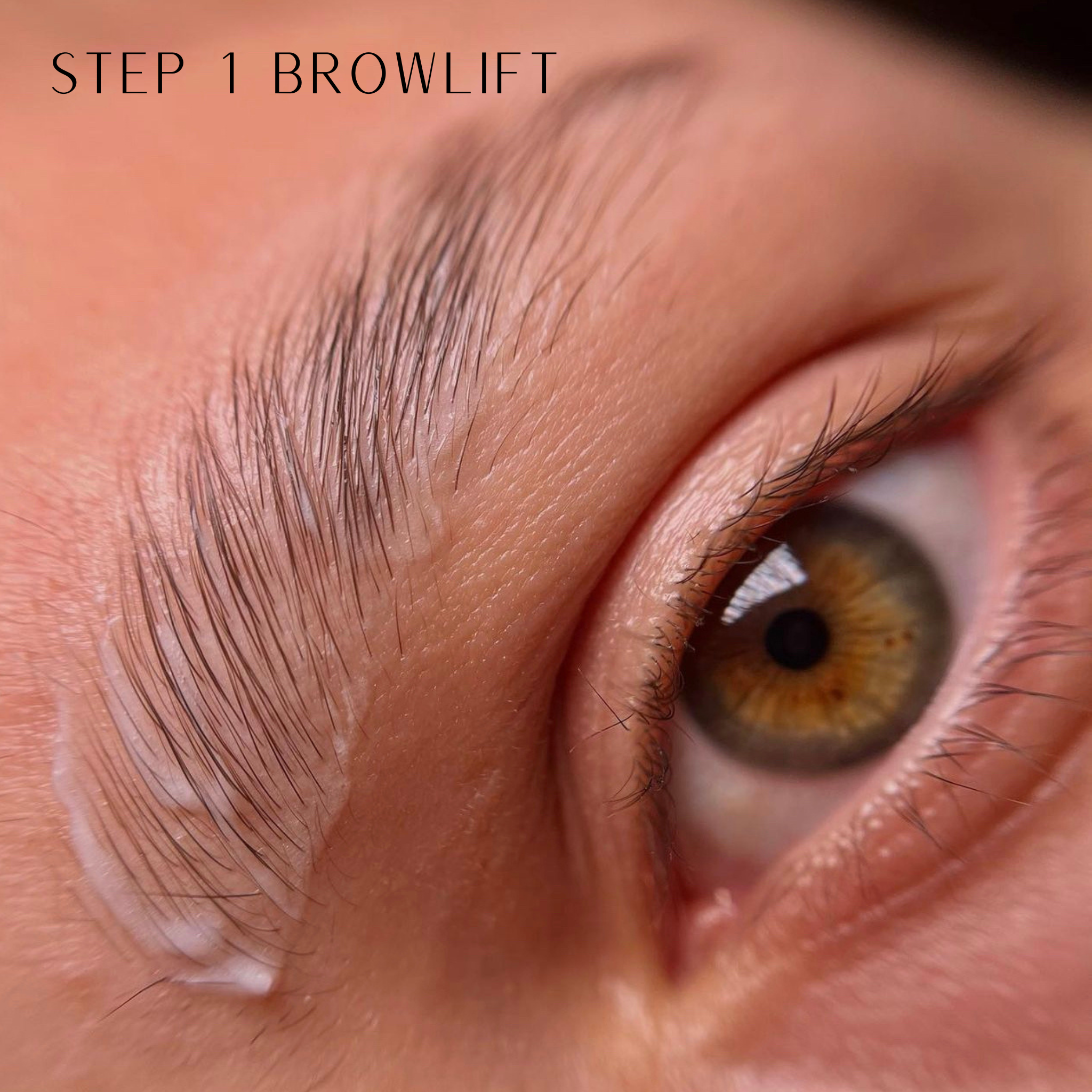 step 1 Browlift Zola