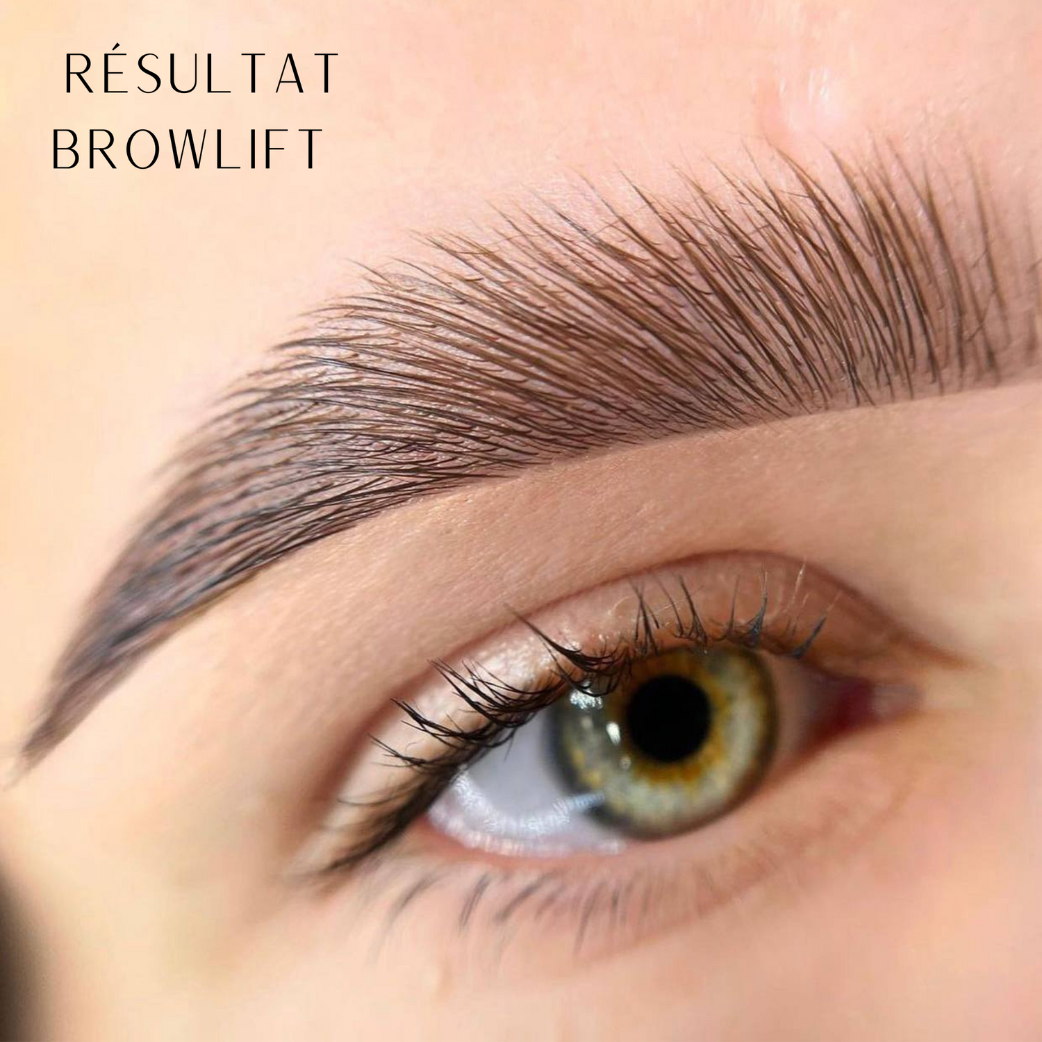 Résultat Browlift Zola