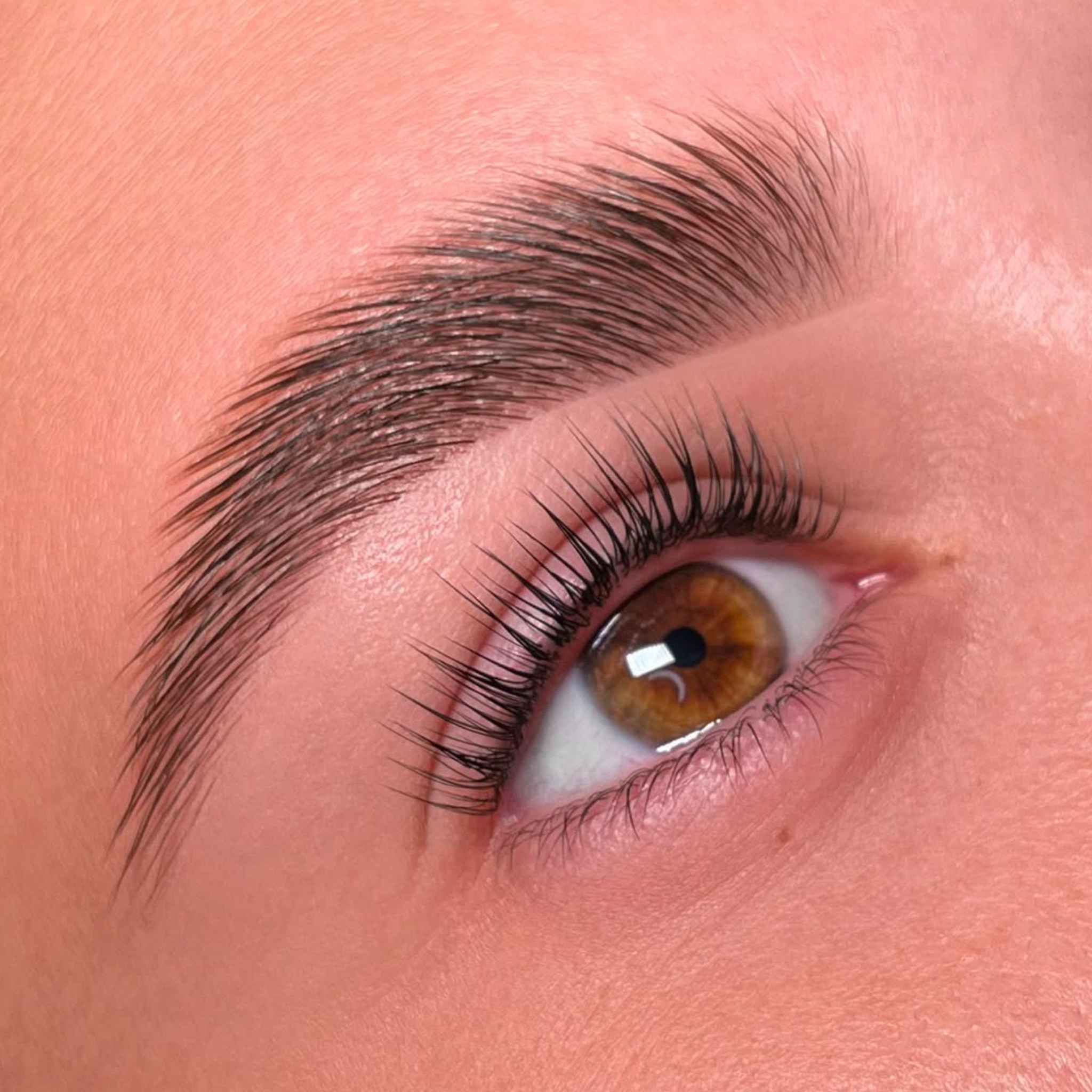 Résultat avec step 3 botox oko