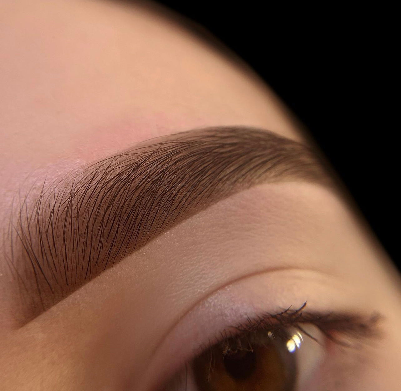 Zoom perfectionnement browlift